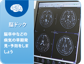 脳ドック